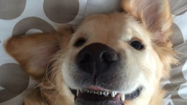 braces