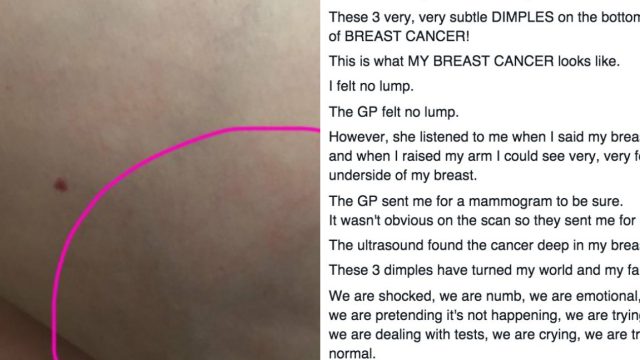 breastcancer