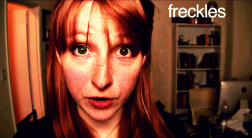 freckles-are-awesome.gif