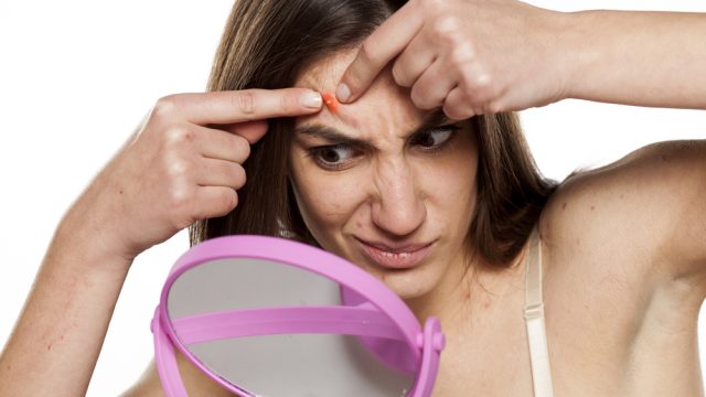 IUD Acne