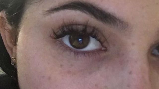 love your freckles kylie jenner