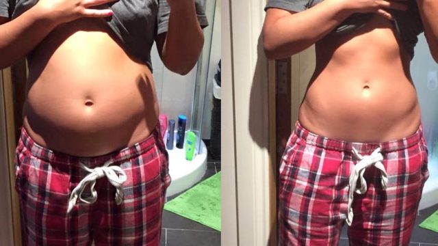 Amandampelvicpt - Can your BELLY BLOAT be influenced by your
