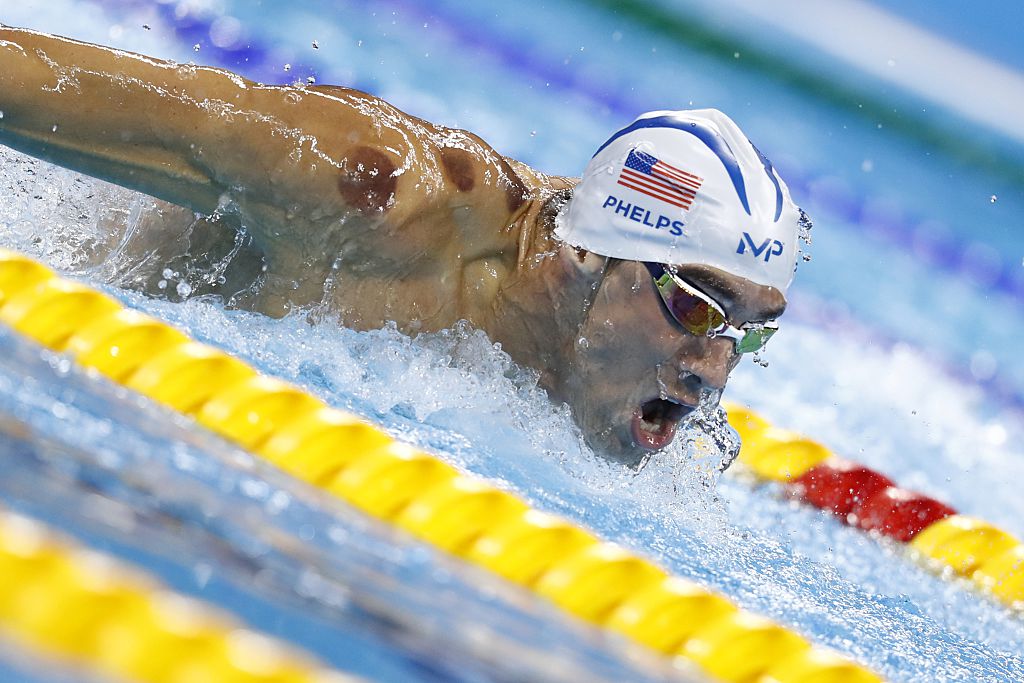 🌟 Did You Know? 🌟 Cupping isn't just for Olympic athletes like Michael  Phelps! 🏊‍♂️ This ancient healing technique has been used for thousands of  years to promote wellness and relaxation. 🍵🌿