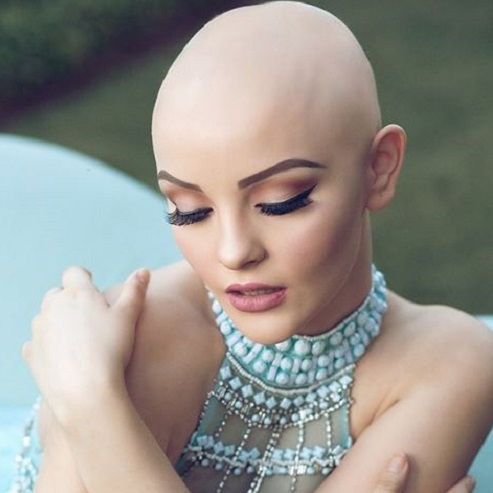This teen girl's fiercely gorgeous photos about losing her hair to  chemotherapy are going viral - HelloGigglesHelloGiggles