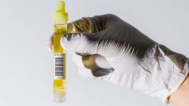 A laboratory assistents hand is presenting a monovette