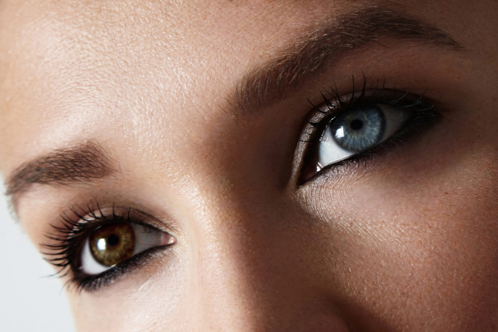 How Rare Are Different-Colored Eyes? Learn All About Heterochromia