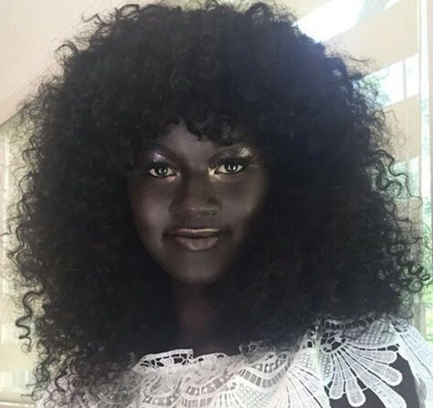 A Gorgeous Babe Woman Once Bullied For Her Dark Skin Is Now A Successful Model