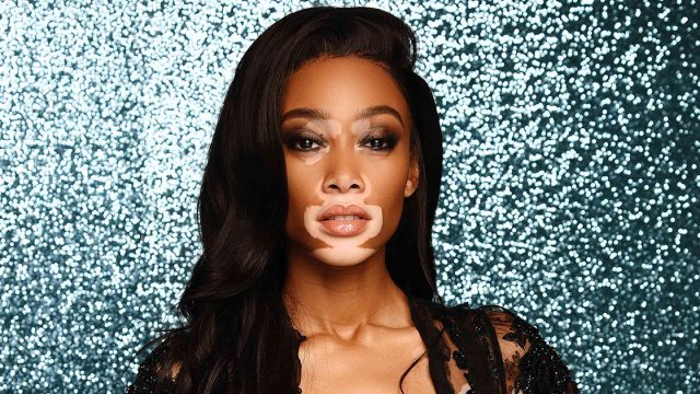Winne Harlow