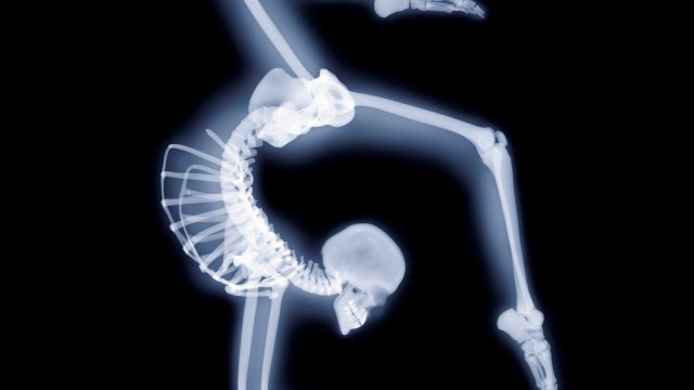 Elbow stand, X-ray artwork
