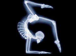 Elbow stand, X-ray artwork