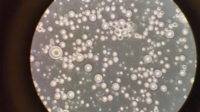 breast-milk-under-microscope