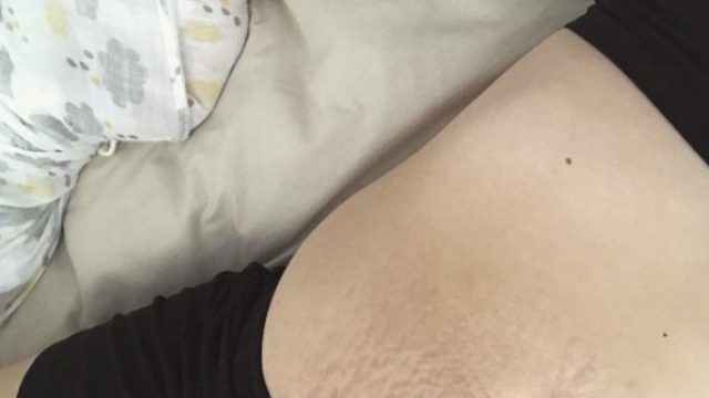 postpartum-body