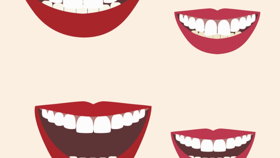 Decoding Dark Humor The Fine Line Between Funny And Racist - 0kgcc2a