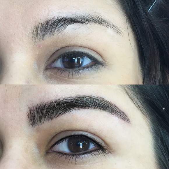 leftbrow_beforeafter.jpg