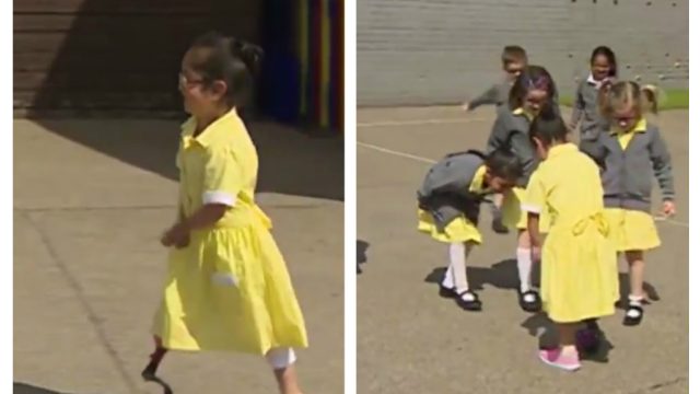 little girl shows new pink prosthetic leg to friends