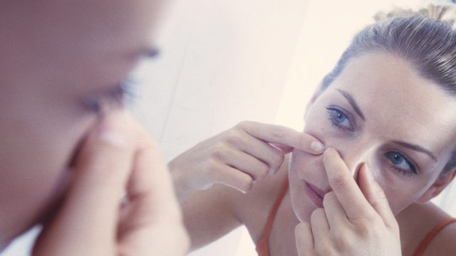 blackhead