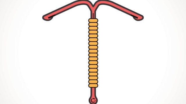 IUD