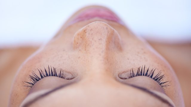retinoids
