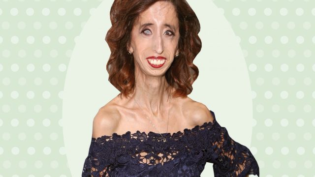 Lizzie Velasquez interview