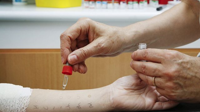 A child gets a prick test for food allergies.