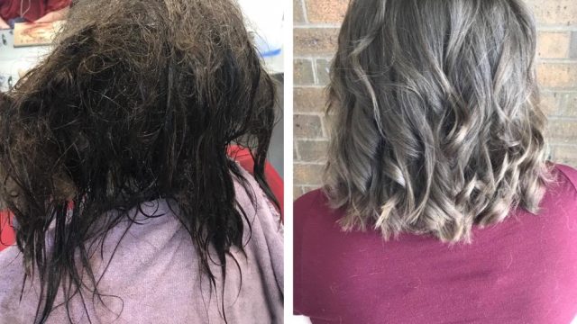 Depression hair before and after