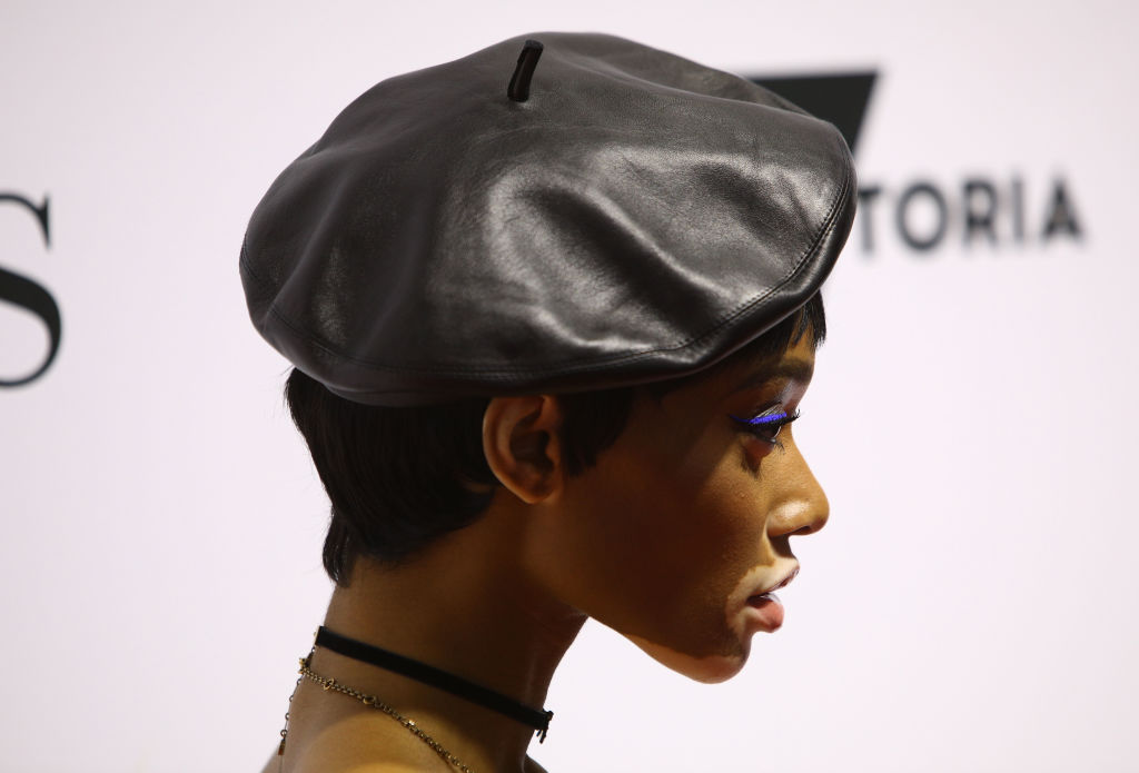 winnie-harlow2.jpg