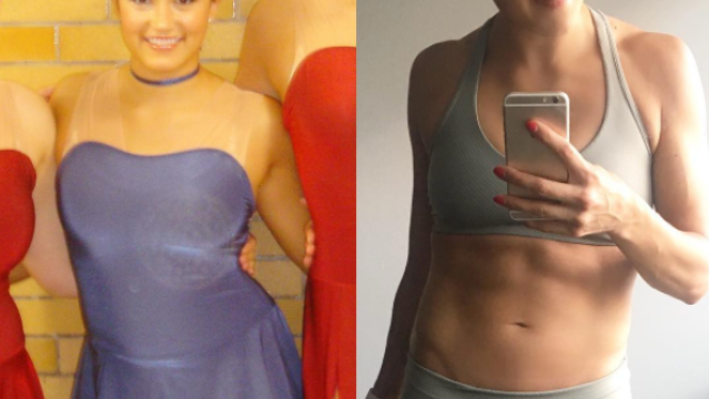 Image of Carissa Seligman before and after anorexia