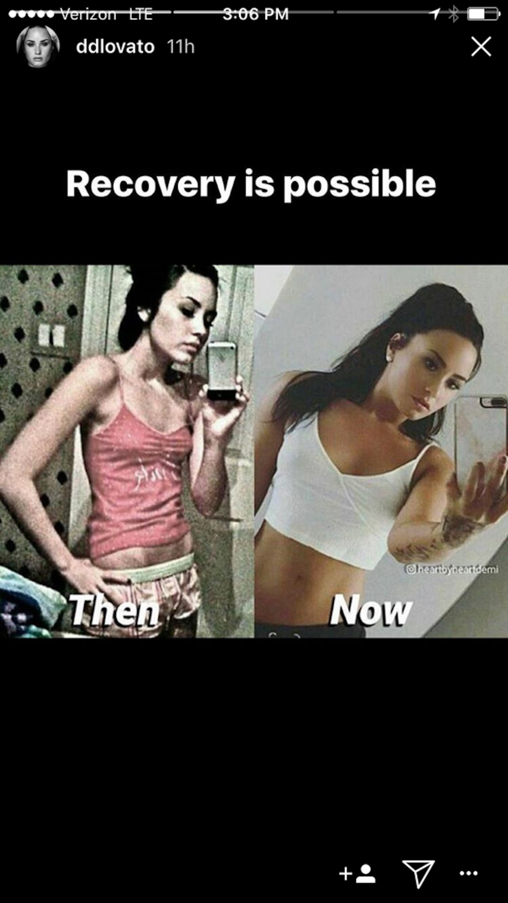demi-lovato-eating-disorder-comparison.png