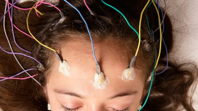 Electroencephalography