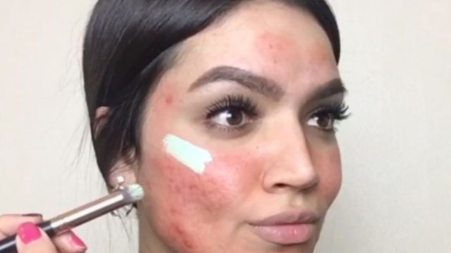 acnemakeup