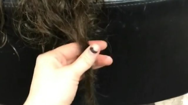 postpartum-hair-loss