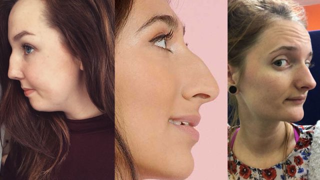 noses