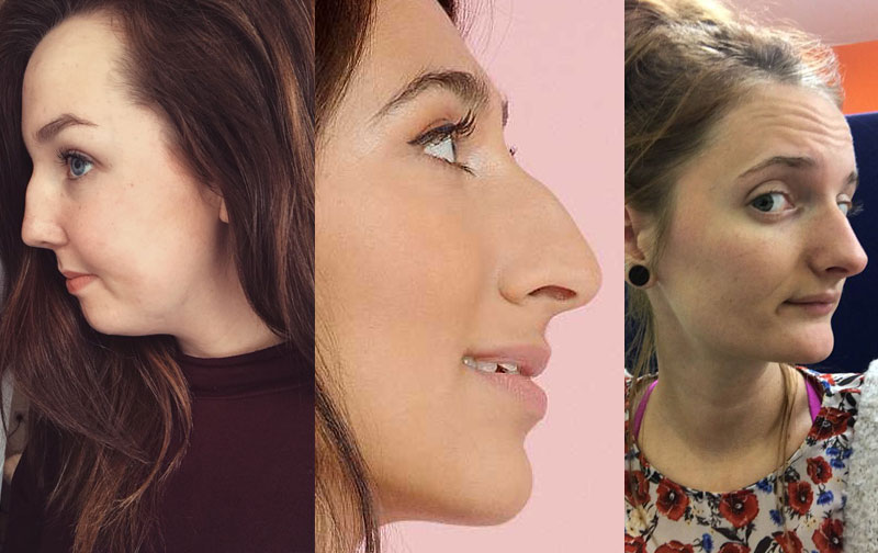 celebrity noses profiles