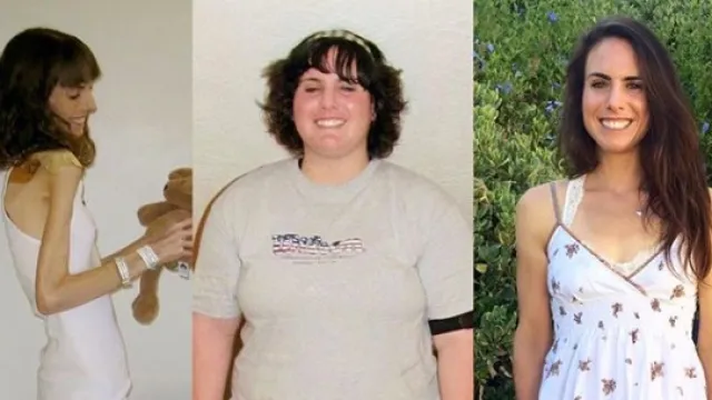 eating disorder