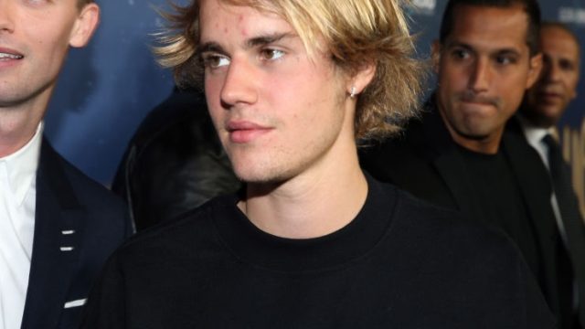 justin-bieber-pimples