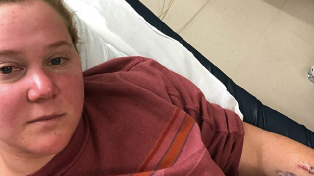amy schumer instagram