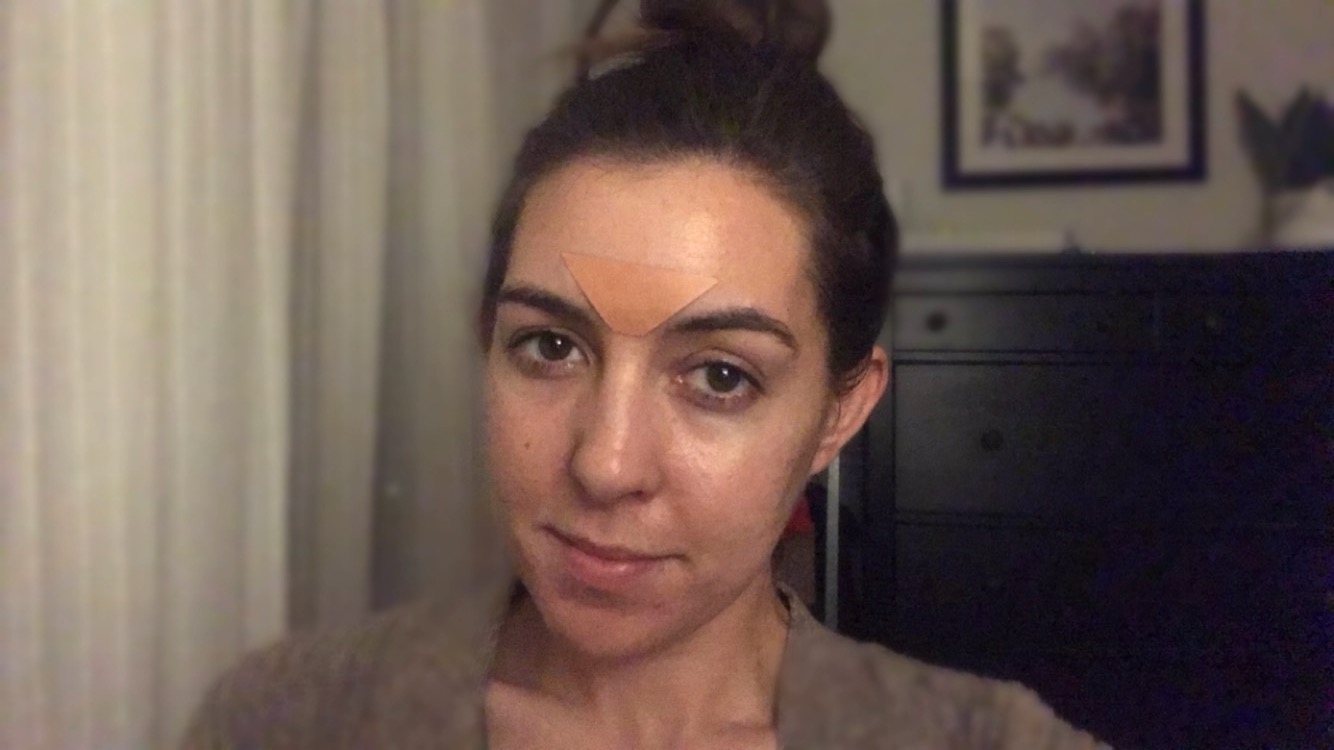 I Tried Frownies To Get Rid of My Forehead WrinkleHelloGiggles