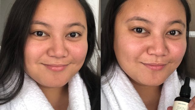 Skin Dope Review