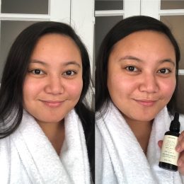 Skin Dope Review
