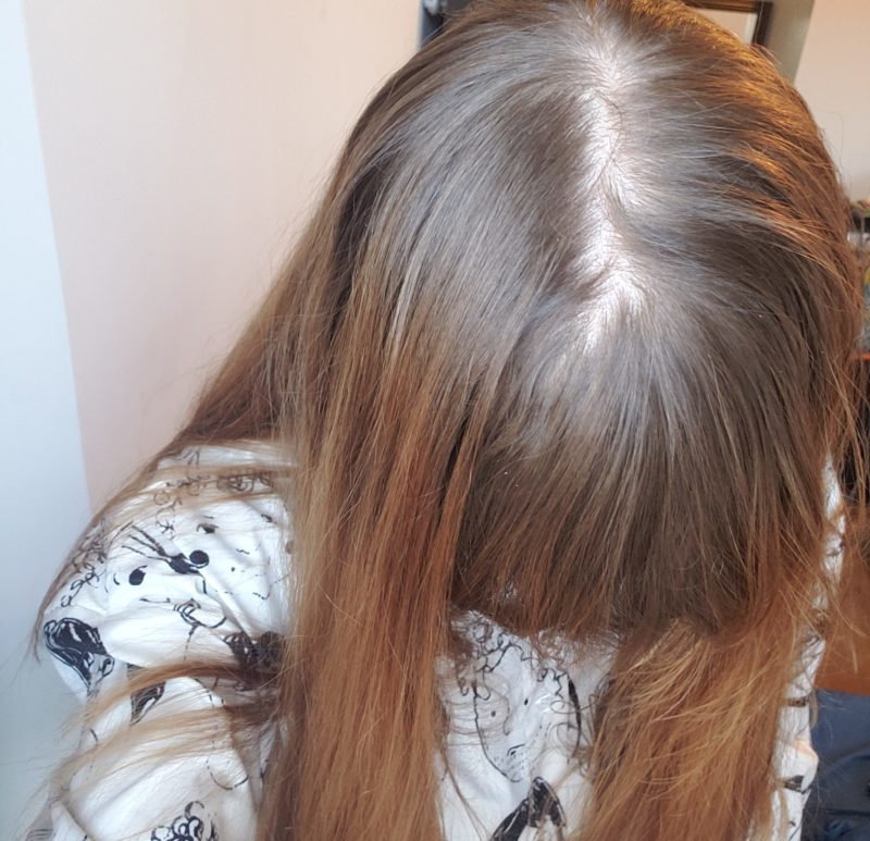 freshscalp1-e1547411437120.jpg