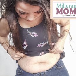 Author looking at stretch marks on her stomach