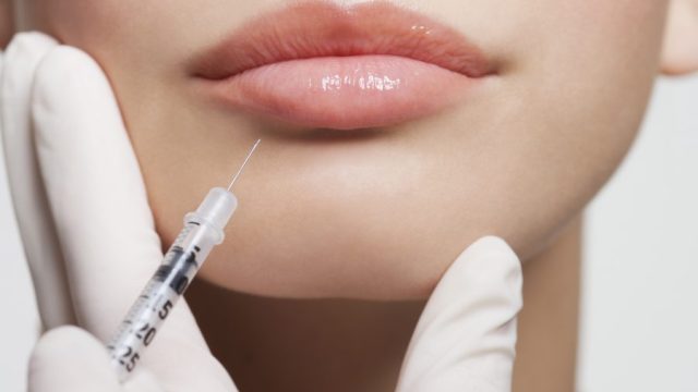 lip injections, lip fillers, lip plumper