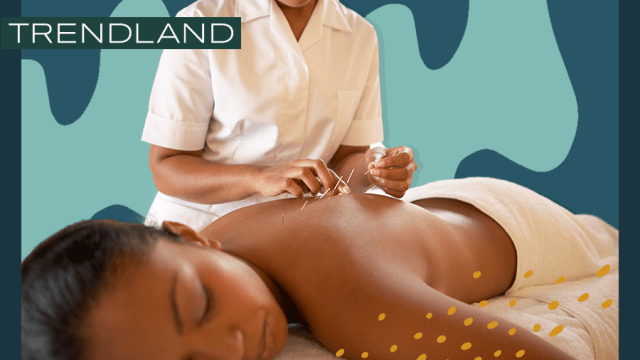 acupuncture