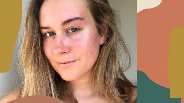 rosacea-skincare-routine