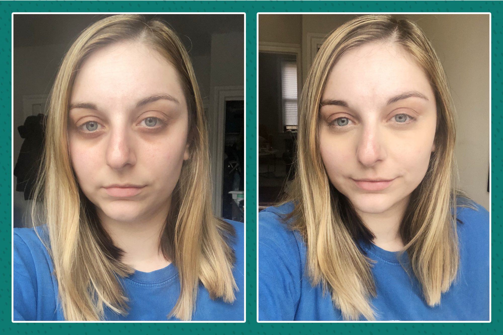How to Color Correct Undereye Circles