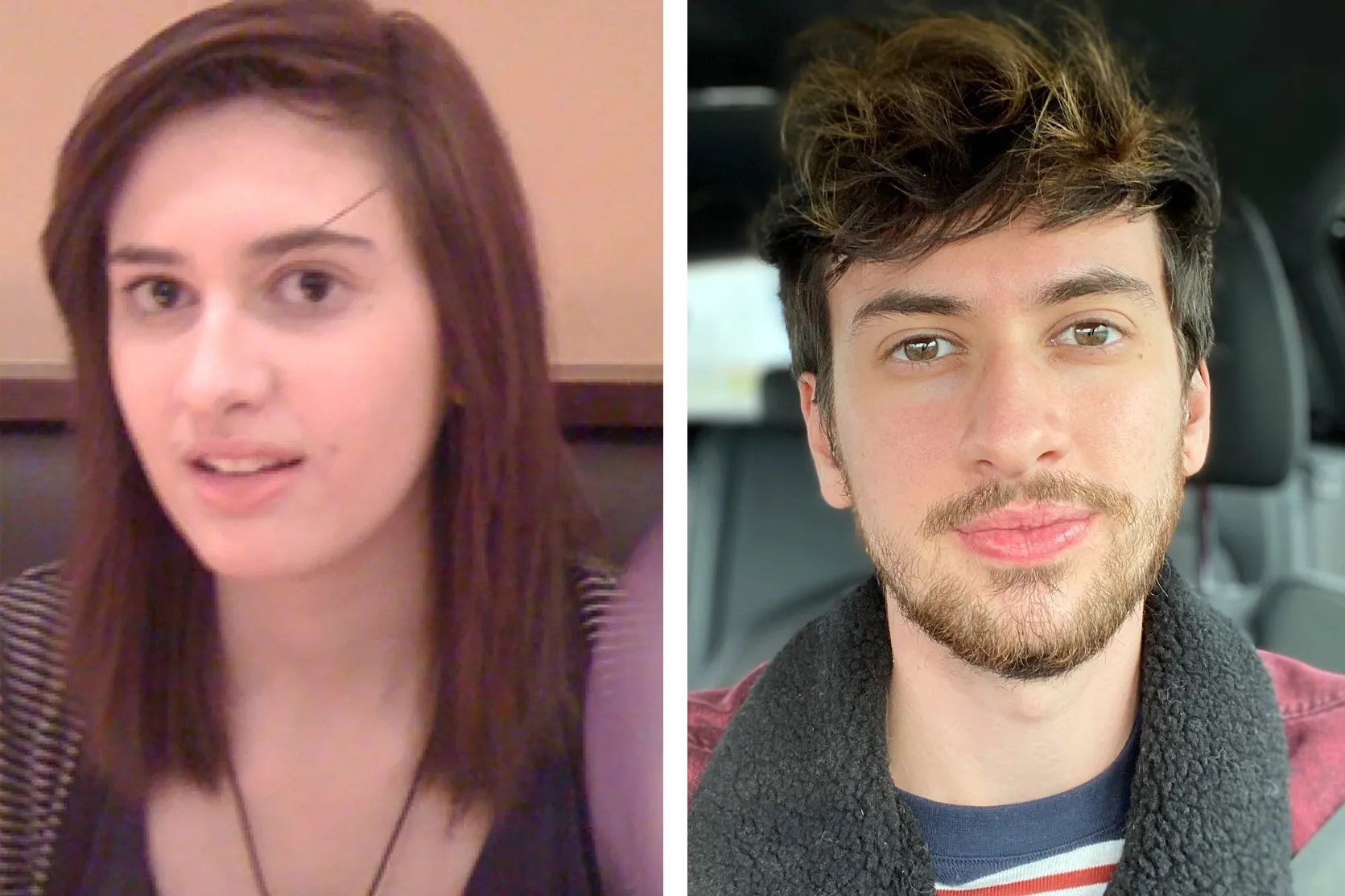 male to female transition before and after photos