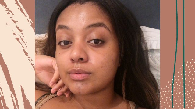 hyperpigmentation skincare routine