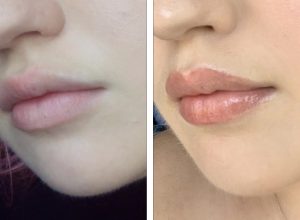 lip blushing review before and after