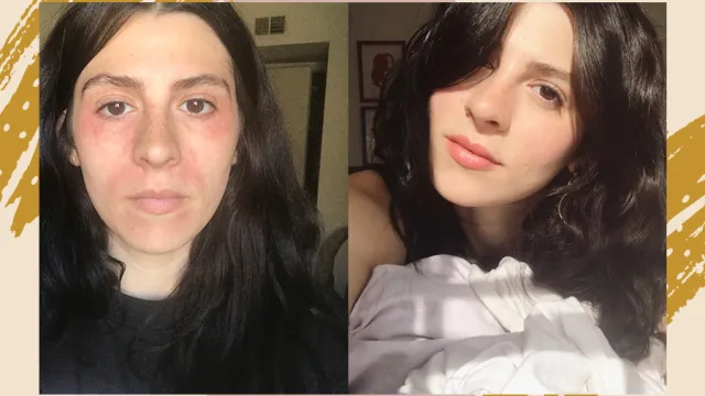 skin barrier before and after