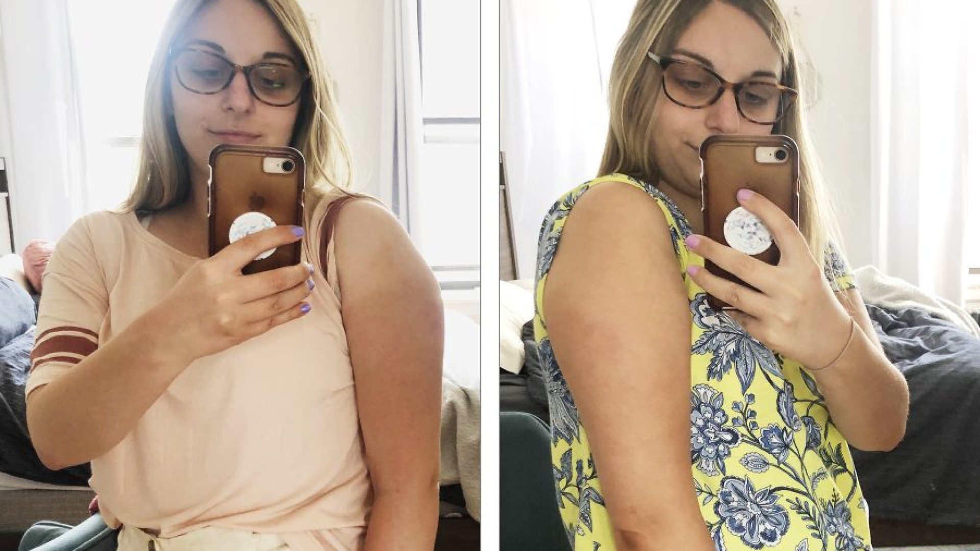 how-to-fix-uneven-tan-lines-according-to-expertshellogiggles